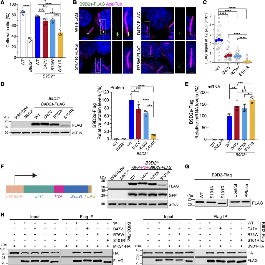 The JBTS- and MKS-associated B9D2 variants compromise TZ localization, b...
