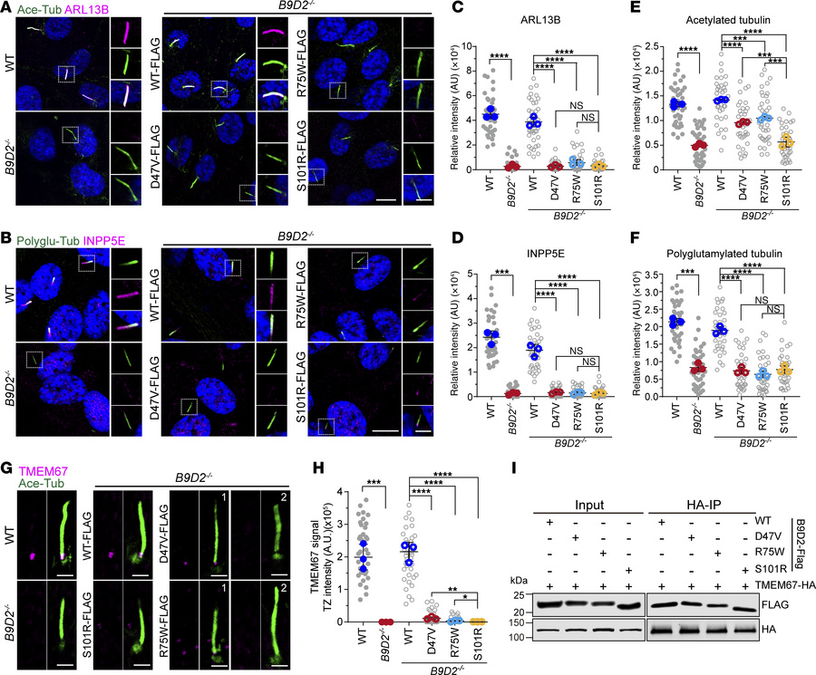Ciliopathy-associated variants in B9D2 impair the integrity of cilia.
(A...