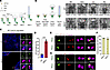 The functions of B9 proteins in early events of ciliogenesis.