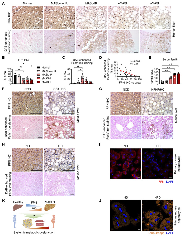 Hepatic FPN expression is downregulated in human and murine MASLD.
(A–C)...