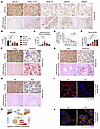 Hepatic FPN expression is downregulated in human and murine MASLD.