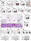 Hepatocyte-specific FPN deletion exacerbates obesity and IR under HFD condi