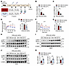 Silencing of fetuin-A and LECT2 ameliorates systemic metabolic dysfunction.