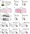 Hepatocyte-specific FPN overexpression improves systemic metabolic dysfunct