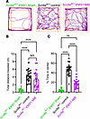 Anxiety and movement discrepancy phenotypes are reduced by SCN8A-ABE treatm