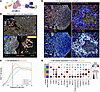 TCF1+TOX+ cell populations colocalize to the peri-islet area in human T1D.