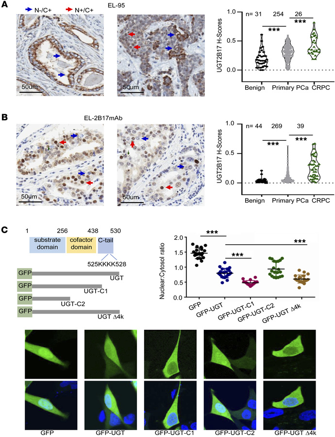 UGT2B17 protein expression is upregulated in CRPC patient tumors.
(A and...