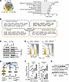 UGT2B17 regulates UPR in PCa cells.