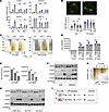 UGT2B17 regulates PERK and IRE1a pathways independent of its androgen-catab