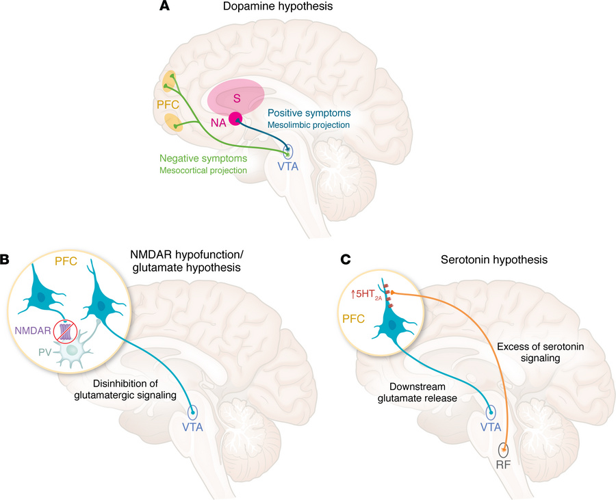 The three hypotheses of psychosis.
(A) The classical theory of psychosis...