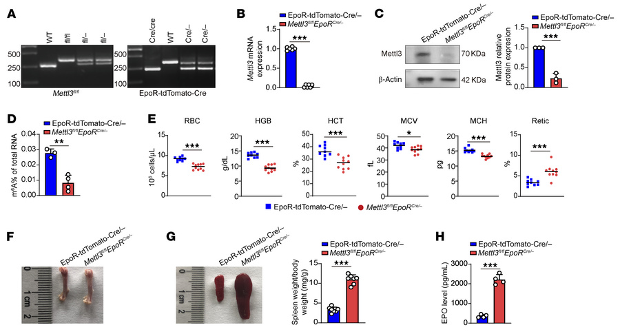 
Mettl3 deletion using EpoR-tdTomato-Cre led to anemia in mice.
(A) PCR ...