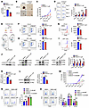 METTL3 inhibition impaired human erythropoiesis.