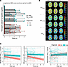 Characterization of longitudinal trajectories of axonal integrity in CN and