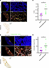 Therapeutic IN Mip3a/relMtb fusion immunization induces local DC infiltrati