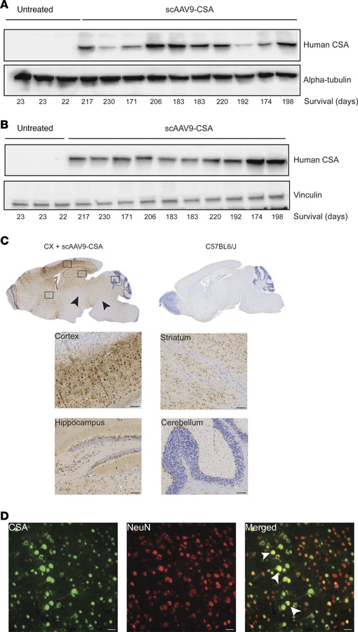 A single neonatal ICV injection of AAV9-CSA results in widespread CSA ex...