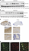A single neonatal ICV injection of AAV9-CSA results in widespread CSA expre