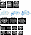 Multimodal brain imaging.