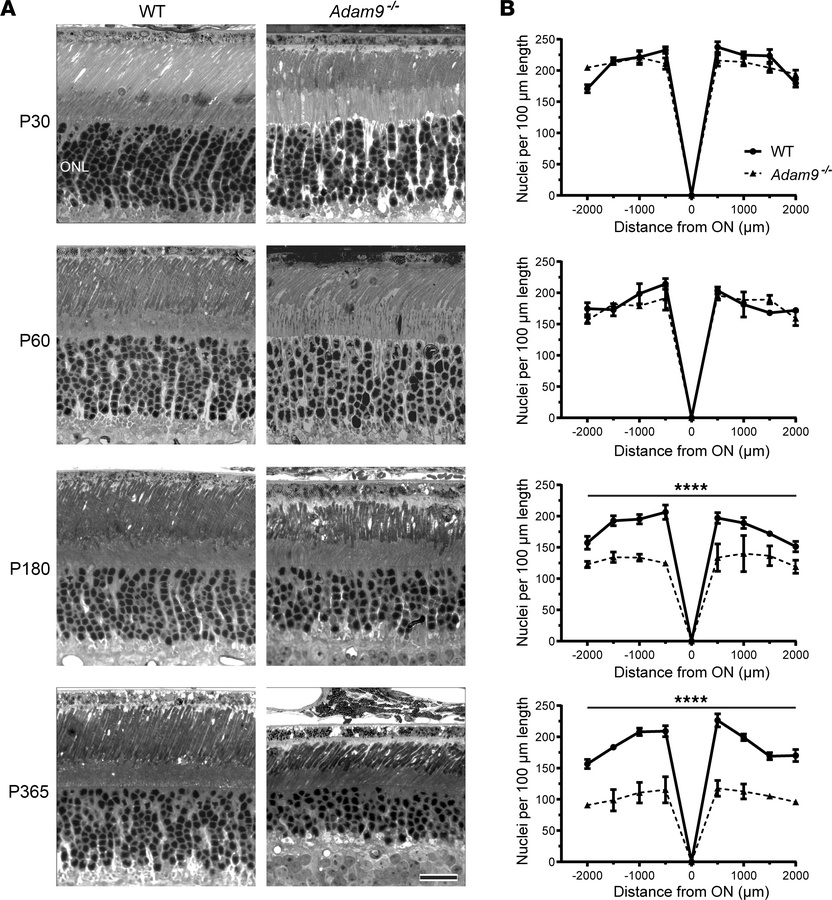 Loss of ADAM9 leads to a slow, progressive photoreceptor degeneration.
(...