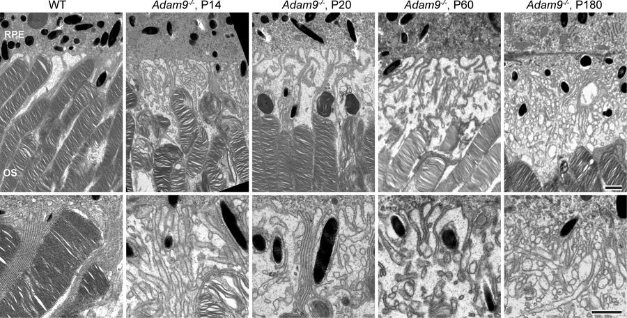 Loss of ADAM9 leads to an early separation of the outer segment–RPE inte...