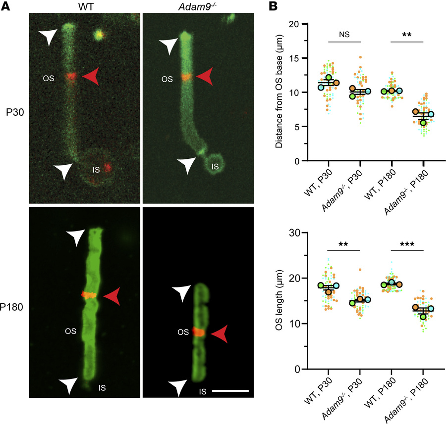 Loss of ADAM9 does not affect the dynamics of outer segment renewal befo...