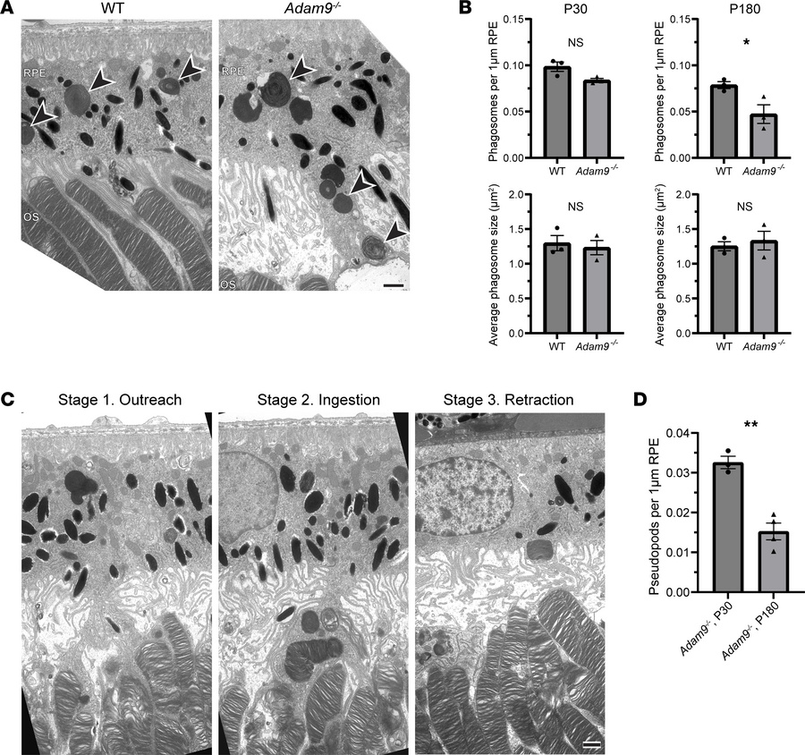 Loss of ADAM9 leads to the formation of elongated RPE pseudopods support...