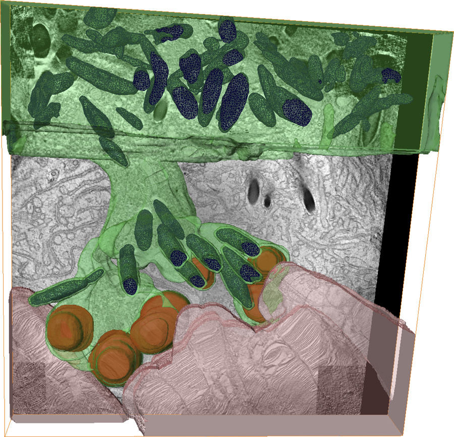 3D reconstruction of an RPE pseudopod reaching across the expanded subre...