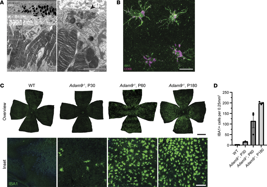 Activated mononuclear phagocytes infiltrate the subretinal space of Adam...