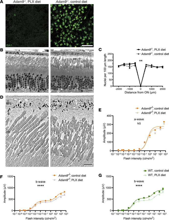 Ablation of subretinal mononuclear phagocytes does not affect the pathol...