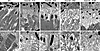 Loss of ADAM9 leads to an early separation of the outer segment–RPE interfa