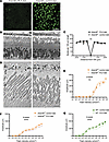 Ablation of subretinal mononuclear phagocytes does not affect the pathology