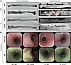 Development of colon tumors in SPF Winnie mice is dependent on the presence