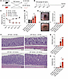 FMT using SPF Winnie and Bl/6 donors indicates that tumor development depen