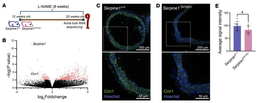 
Ccn1 transcript and protein expression is altered in aortas from Serpin...