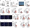 NAT10 deficiency attenuates CRC progression and activates antitumor immunit