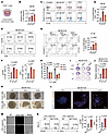 NAT10 deficiency in tumor cells enhances CD8+ T cell infiltration and cytot