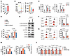 DKK2 promotes CD8+ T cell dysfunction via cholesterol accumulation.