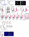 Local delivery of LNP-siPP2Ac promotes tumor immunogenicity in MB.