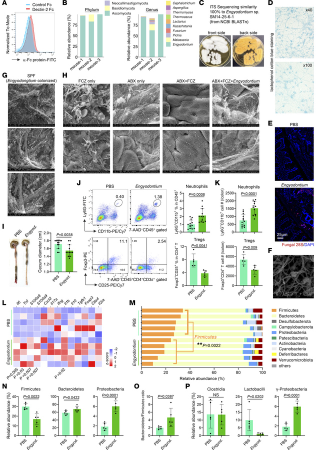 
Engyodontium sp. colonization modifies intestinal immune profiles and c...
