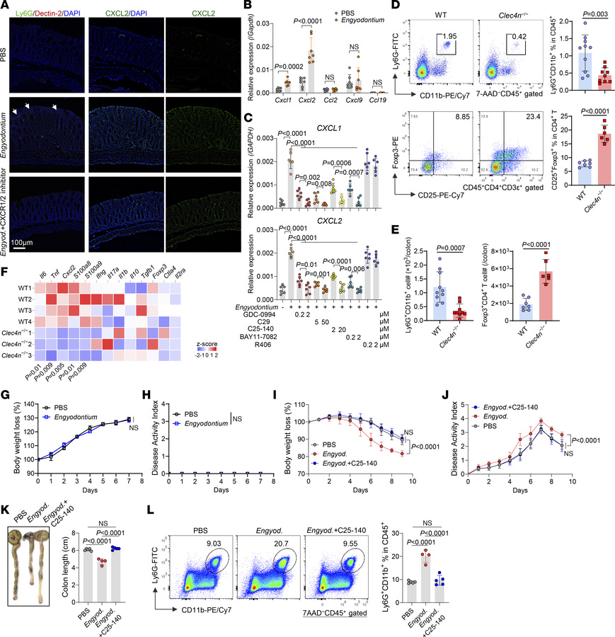 
Engyodontium induces epithelial chemokine production to recruit neutrop...