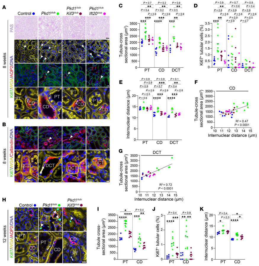 
Pkd1 deletion drives cilia-dependent distal tubule distension independe...