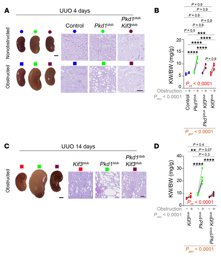 Ureteral obstruction triggers explosive cystogenesis in Pkd1Δtub distal ...
