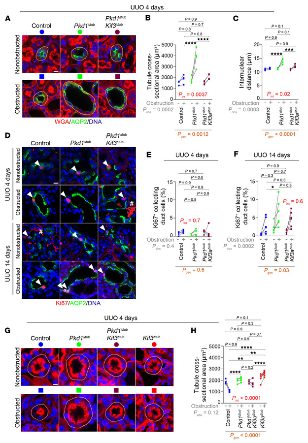 Accelerated cystogenesis after obstruction correlates with tubule disten...