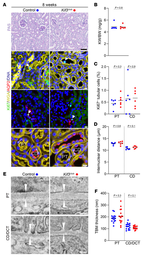 
Kif3a inactivation alone does not lead to tubule distension.
(A) PAS st...