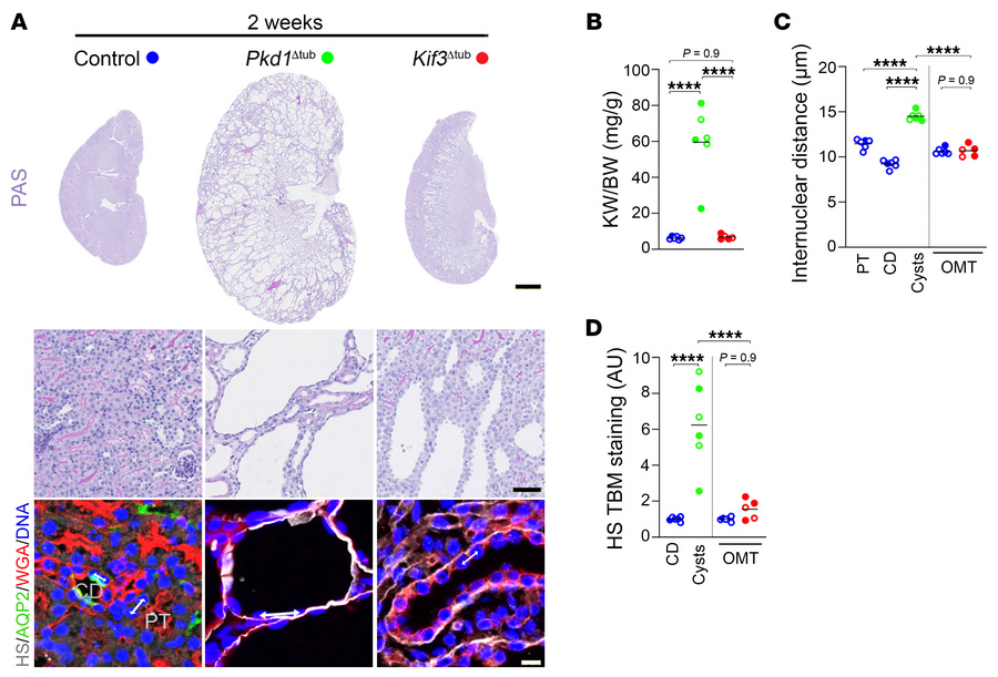Comparison between neonatal cilia and Pkd1 loss reveals distinct modes o...