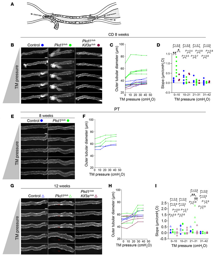 
Pkd1 deletion alters tubule biomechanics.
(A) Scheme of isolated intact...