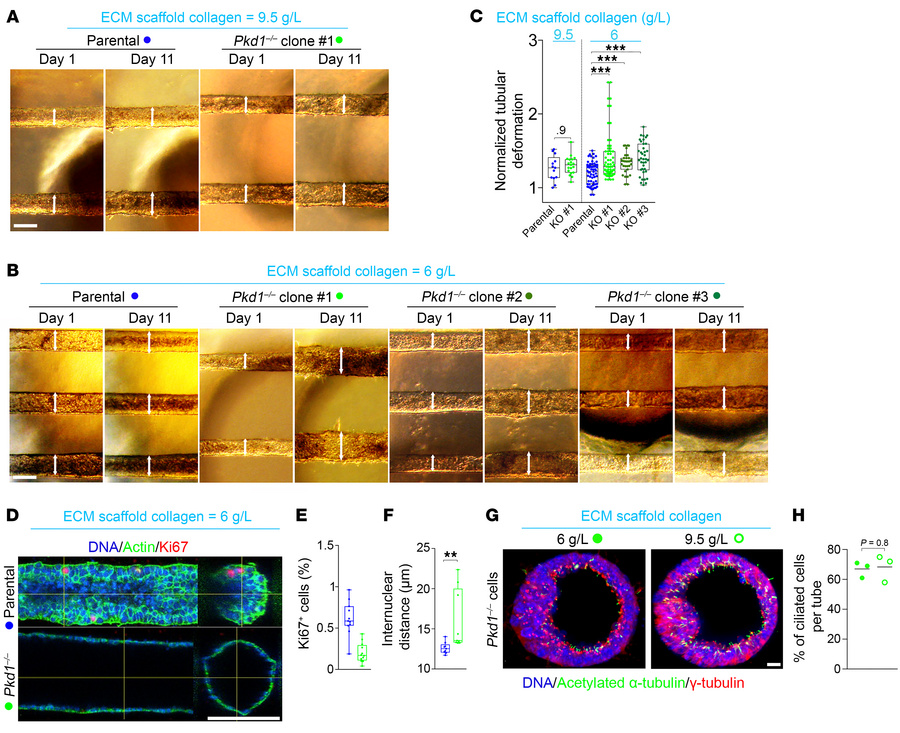ECM mechanics modulate Pkd1–/– tubule-on-chip dilation in vitro.
(A and ...