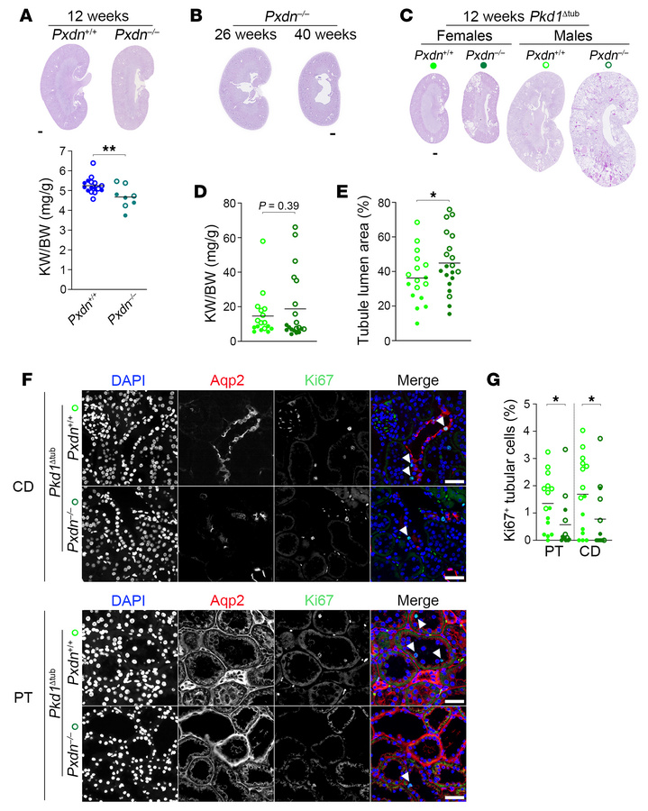 Decrease in TBM stiffness promotes cyst formation in vivo.
(A) PAS stain...