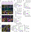 Pkd1 deletion drives cilia-dependent distal tubule distension independently