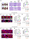 Acute ureteral obstruction accelerates Pkd1Δtub distal tubule dilation in a