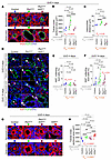 Accelerated cystogenesis after obstruction correlates with tubule distensio